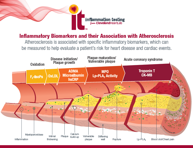 Cardiovascular Disease Inflammatory Biomarkers